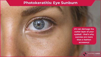 Photokeratitis article header